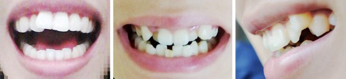 ݲ