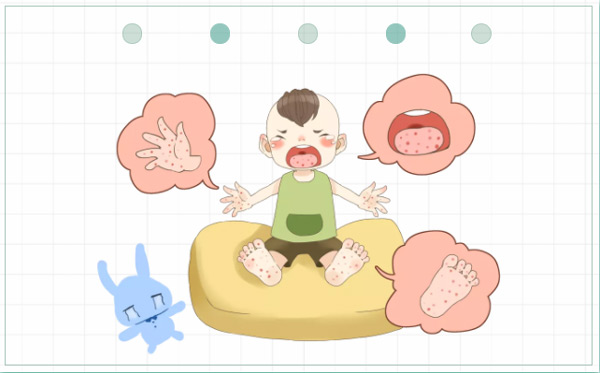 手足口病 手足口病