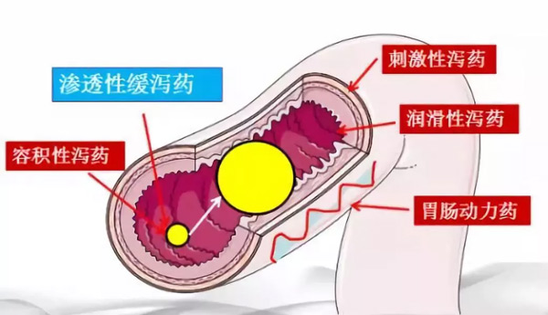 治便秘用泻药?你知道危害有多大吗? 治便秘用泻药?你知道危害有多大吗?