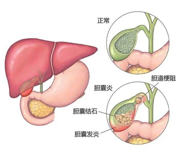 体检报告你会看吗?这些指标异常未必就是病 体检报告你会看吗?这些指标异常未必就是病