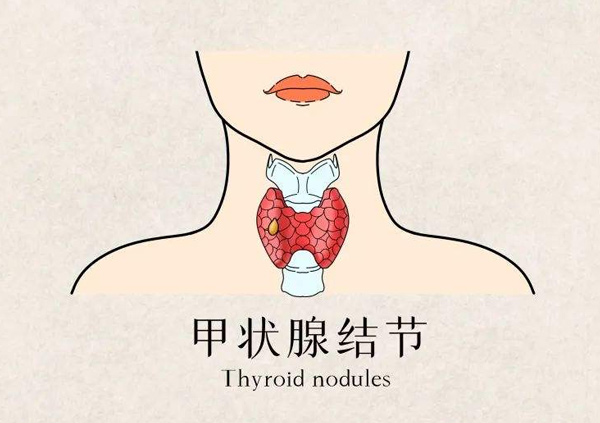 体检报告你会看吗?这些指标异常未必就是病 体检报告你会看吗?这些指标异常未必就是病