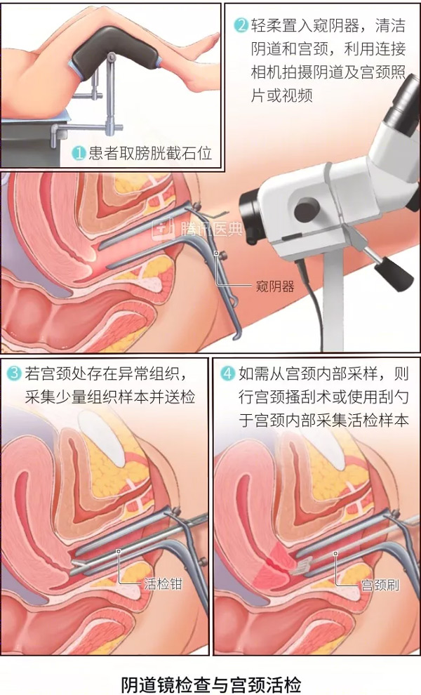 “活检”是什么?怎么做? “活检”是什么?怎么做?