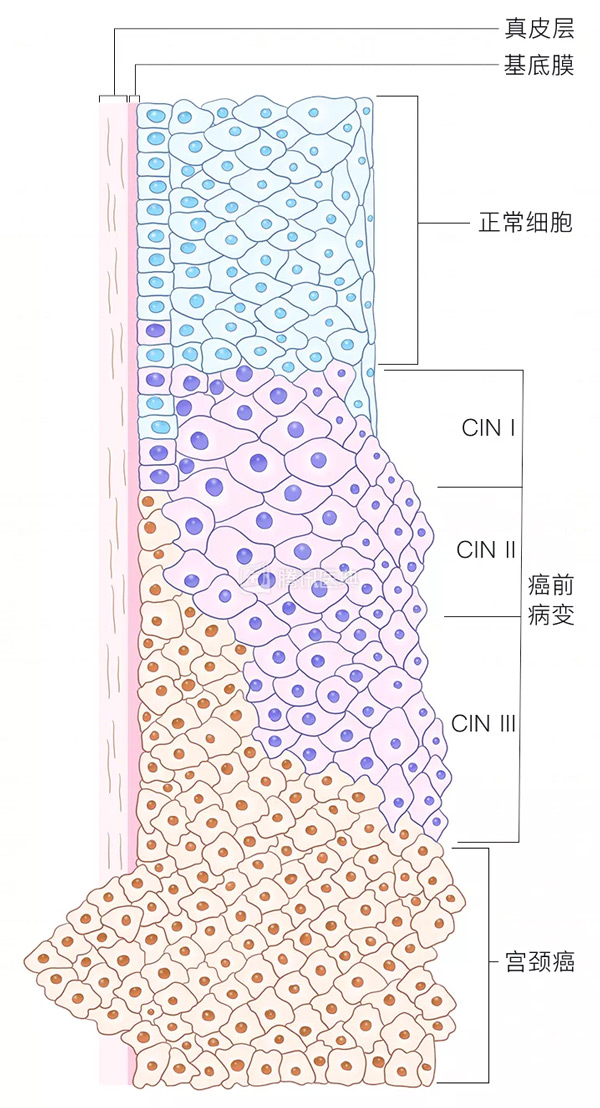 “活检”是什么?怎么做? “活检”是什么?怎么做?