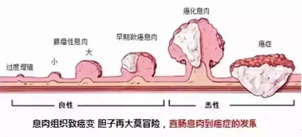 ϢⰩ